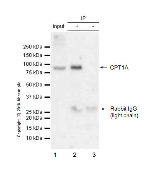 Immunoprecipitation - Anti-CPT1A antibody [EPR21843-71-1C] - BSA and Azide free (AB234906)