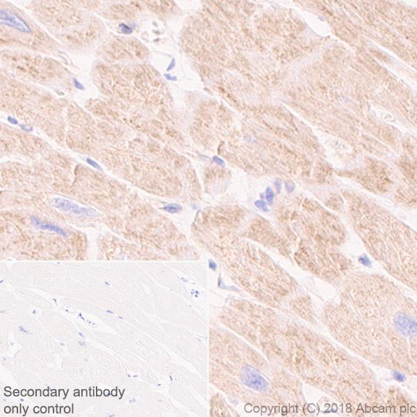 Immunohistochemistry (Formalin/PFA-fixed paraffin-embedded sections) - Anti-CPT1A antibody [EPR21843-71-2F] (ab234111), expandable thumbnail
