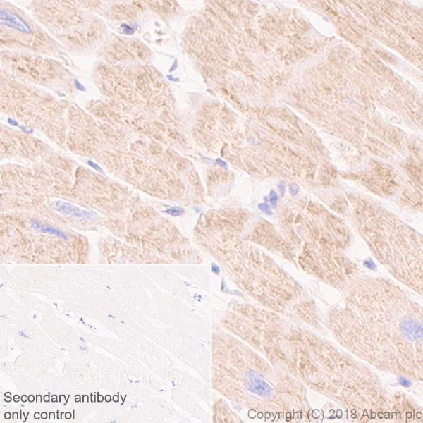 Immunohistochemistry (Formalin/PFA-fixed paraffin-embedded sections) - Anti-CPT1A antibody [EPR21843-71-2F] (AB234111)