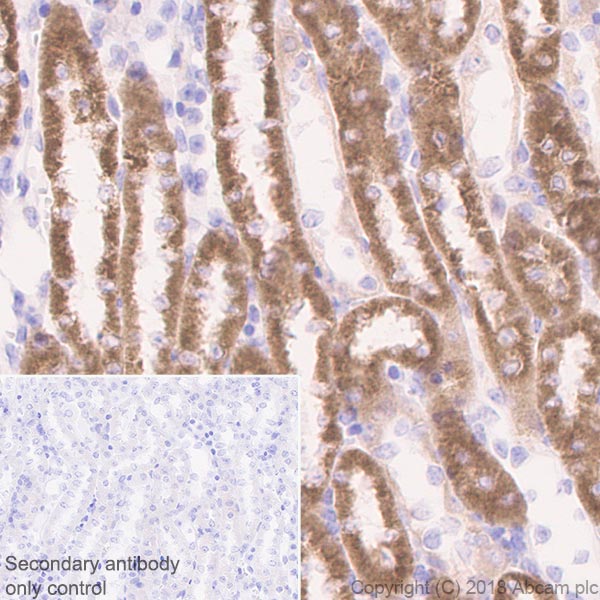 Immunohistochemistry (Formalin/PFA-fixed paraffin-embedded sections) - Anti-CPT1A antibody [EPR21843-71-2F] (AB234111), expandable thumbnail