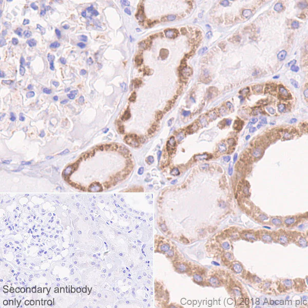 Immunohistochemistry (Formalin/PFA-fixed paraffin-embedded sections) - Anti-CPT1A antibody [EPR21843-71-2F] (AB234111)