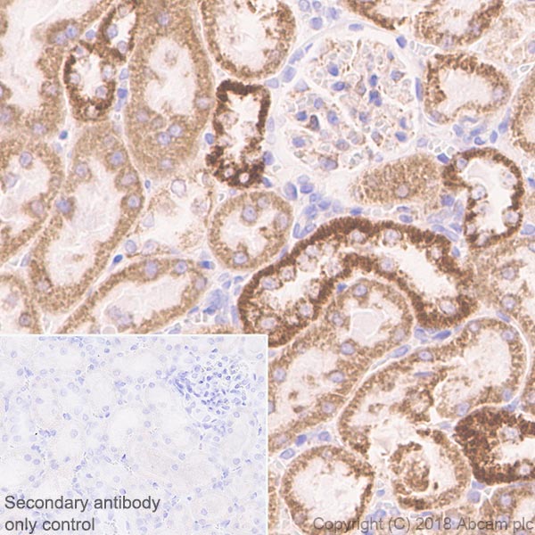 Immunohistochemistry (Formalin/PFA-fixed paraffin-embedded sections) - Anti-CPT1A antibody [EPR21843-71-2F] (AB234111), expandable thumbnail