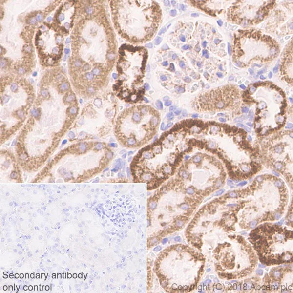 Immunohistochemistry (Formalin/PFA-fixed paraffin-embedded sections) - Anti-CPT1A antibody [EPR21843-71-2F] - BSA and Azide free (AB235841)