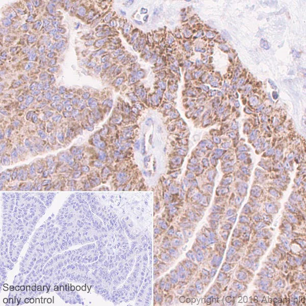 Immunohistochemistry (Formalin/PFA-fixed paraffin-embedded sections) - Anti-CPT1A antibody [EPR21843-71-2F] - BSA and Azide free (AB235841)