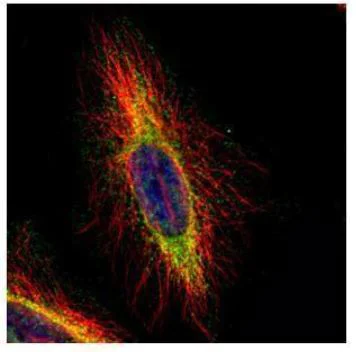 Immunocytochemistry/ Immunofluorescence - Anti-CPT1B antibody (AB272896)