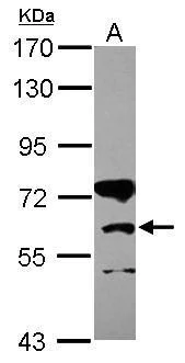 Western blot - Anti-CPT1B antibody (AB272896)