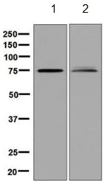 Western blot - Anti-CPT1B antibody [EPR7838] (AB134135)