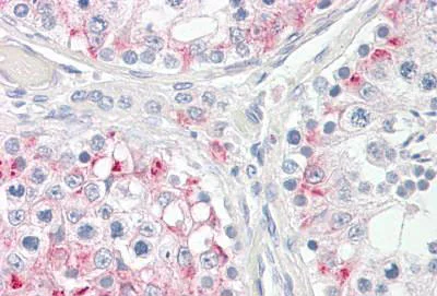 Immunohistochemistry (Formalin/PFA-fixed paraffin-embedded sections) - Anti-Cpt1c/CPT1-B antibody (AB189182)