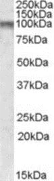 Western blot - Anti-Cpt1c/CPT1-B antibody (AB189182)