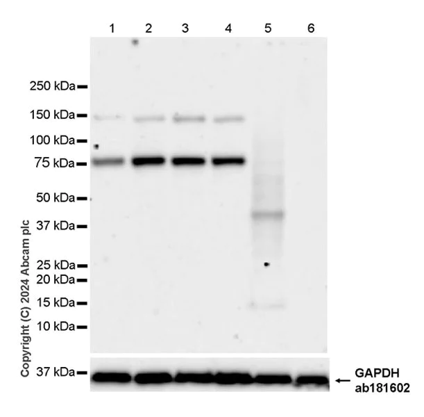 Western blot - Anti-Cpt1c/CPT1-B antibody [EPR28434-111] - BSA and Azide free (AB316934)