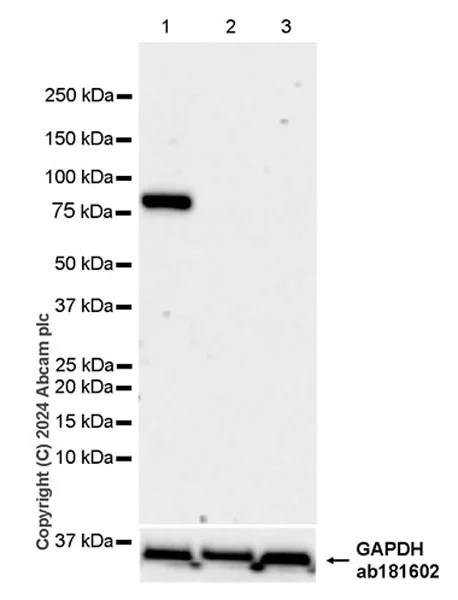 Western blot - Anti-Cpt1c/CPT1-B antibody [EPR28434-111] - BSA and Azide free (AB316934)
