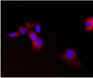 Immunocytochemistry/ Immunofluorescence - Anti-CPT2 antibody [1C2AE6] (AB110293), expandable thumbnail