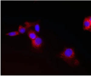 Immunocytochemistry/ Immunofluorescence - Anti-CPT2 antibody [1C2AE6] (AB110293)