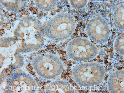 Immunohistochemistry (Formalin/PFA-fixed paraffin-embedded sections) - Anti-CPT2 antibody [1C2AE6] (AB110293), expandable thumbnail
