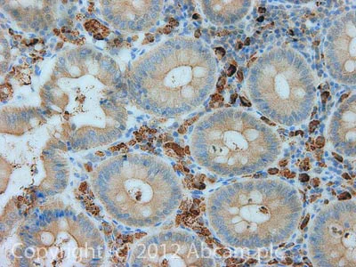 Immunohistochemistry (Formalin/PFA-fixed paraffin-embedded sections) - Anti-CPT2 antibody [1C2AE6] (AB110293)