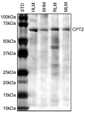 Immunoprecipitation - Anti-CPT2 antibody [1C2AE6] (AB110293), expandable thumbnail