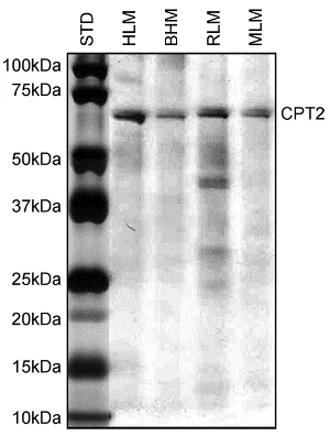 Immunoprecipitation - Anti-CPT2 antibody [1C2AE6] (AB110293)