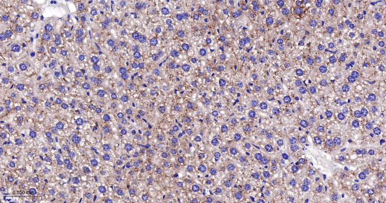 Immunohistochemistry (Formalin/PFA-fixed paraffin-embedded sections) - Anti-CPT2 antibody [3B10] (AB326710)