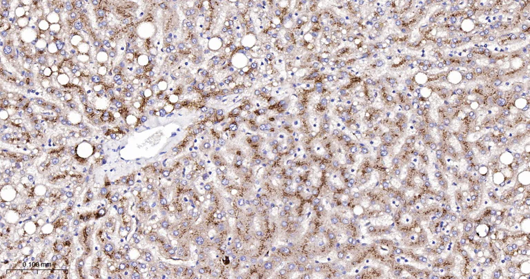 Immunohistochemistry (Formalin/PFA-fixed paraffin-embedded sections) - Anti-CPT2 antibody [3B10] (AB326710)