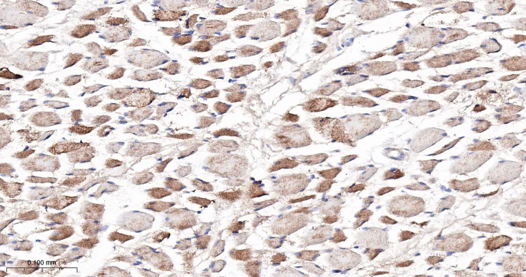 Immunohistochemistry (Formalin/PFA-fixed paraffin-embedded sections) - Anti-CPT2 antibody [3B10] (AB326710)
