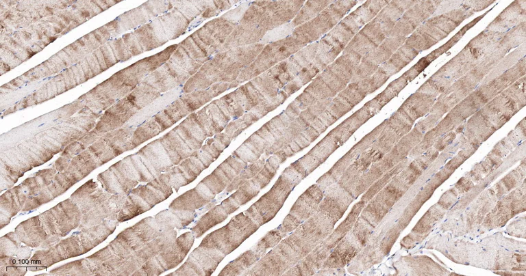 Immunohistochemistry (Formalin/PFA-fixed paraffin-embedded sections) - Anti-CPT2 antibody [3B10] (AB326710)