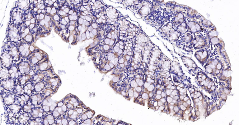 Immunohistochemistry (Formalin/PFA-fixed paraffin-embedded sections) - Anti-CPT2 antibody [3B10] (AB326710)