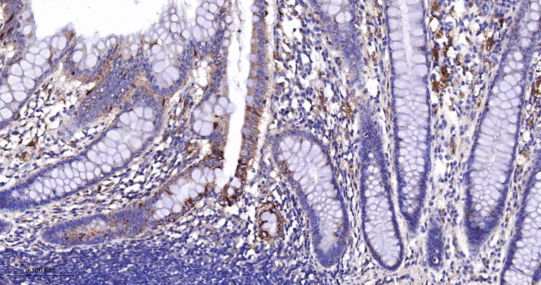 Immunohistochemistry (Formalin/PFA-fixed paraffin-embedded sections) - Anti-CPT2 antibody [3B10] (AB326710)