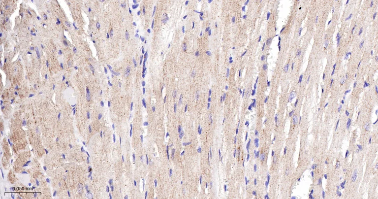 Immunohistochemistry (Formalin/PFA-fixed paraffin-embedded sections) - Anti-CPT2 antibody [3B10] (AB326710)