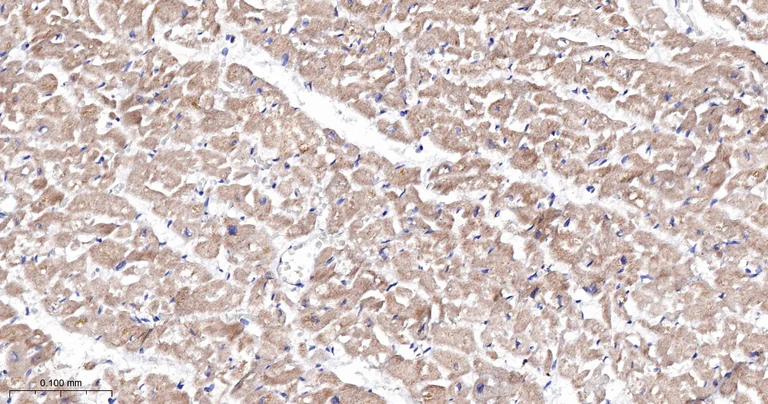 Immunohistochemistry (Formalin/PFA-fixed paraffin-embedded sections) - Anti-CPT2 antibody [3B10] (AB326710)