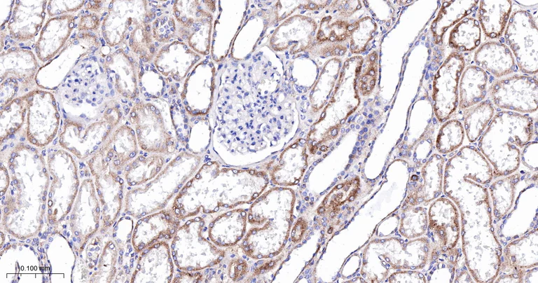 Immunohistochemistry (Formalin/PFA-fixed paraffin-embedded sections) - Anti-CPT2 antibody [3B10] (AB326710)