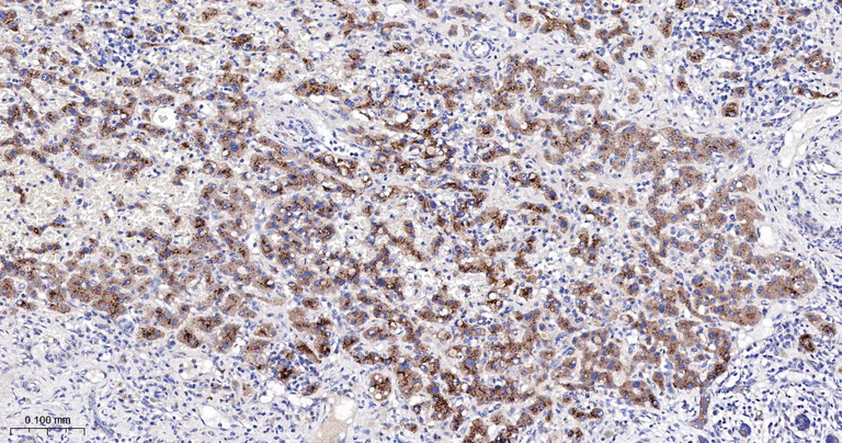 Immunohistochemistry (Formalin/PFA-fixed paraffin-embedded sections) - Anti-CPT2 antibody [3B10] (AB326710)