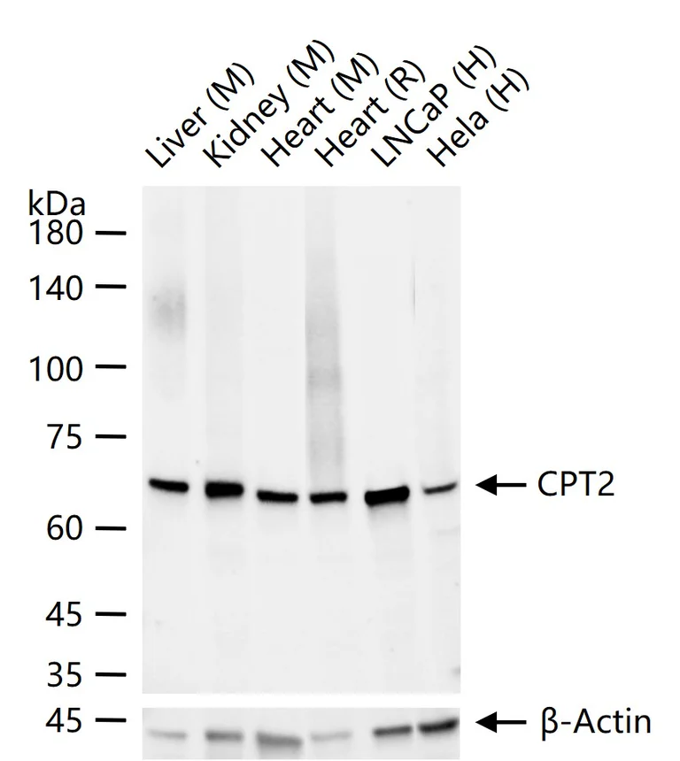 Western blot - Anti-CPT2 antibody [3B10] (AB326710)