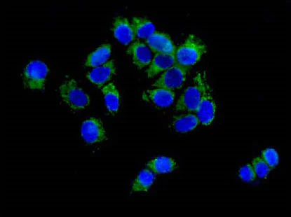 Immunocytochemistry/ Immunofluorescence - Anti-CPT2 antibody [EPR13626] - BSA and Azide free (AB231162)