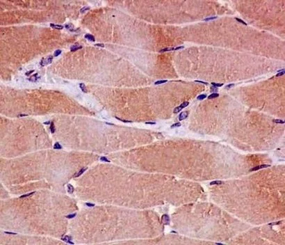 Immunohistochemistry (Formalin/PFA-fixed paraffin-embedded sections) - Anti-CPT2 antibody [EPR13626] - BSA and Azide free (AB231162)