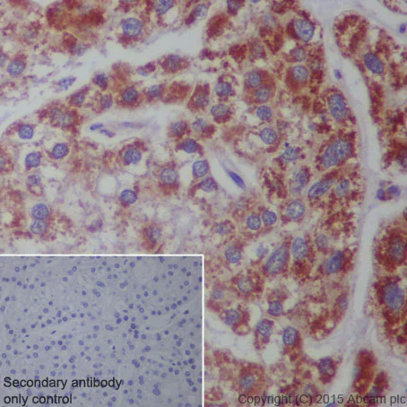 Immunohistochemistry (Formalin/PFA-fixed paraffin-embedded sections) - Anti-CPT2 antibody [EPR13626] - BSA and Azide free (AB231162)