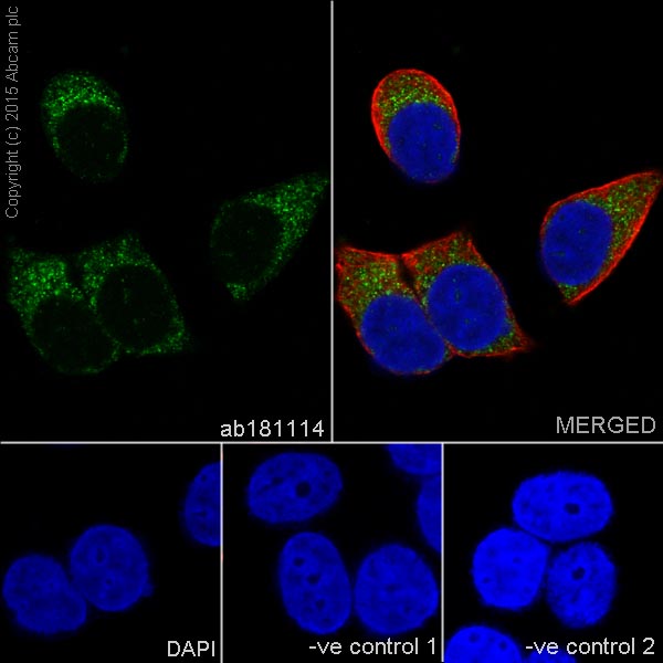 Immunocytochemistry/ Immunofluorescence - Anti-CPT2 antibody [EPR13626] - C-terminal (AB181114), expandable thumbnail