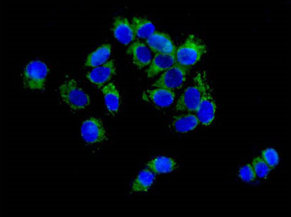 Immunocytochemistry/ Immunofluorescence - Anti-CPT2 antibody [EPR13626] - C-terminal (ab181114), expandable thumbnail