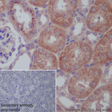 Immunohistochemistry (Formalin/PFA-fixed paraffin-embedded sections) - Anti-CPT2 antibody [EPR13626] - C-terminal (ab181114), expandable thumbnail