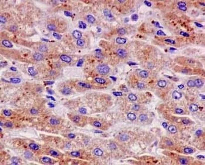 Immunohistochemistry (Formalin/PFA-fixed paraffin-embedded sections) - Anti-CPT2 antibody [EPR13626] - C-terminal (AB181114)
