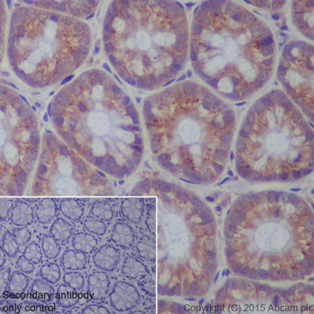 Immunohistochemistry (Formalin/PFA-fixed paraffin-embedded sections) - Anti-CPT2 antibody [EPR13626] - C-terminal (ab181114), expandable thumbnail