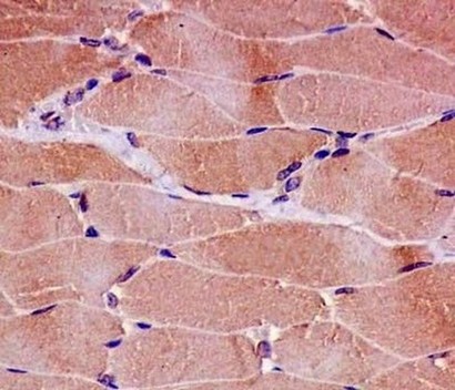 Immunohistochemistry (Formalin/PFA-fixed paraffin-embedded sections) - Anti-CPT2 antibody [EPR13626] - C-terminal (ab181114), expandable thumbnail