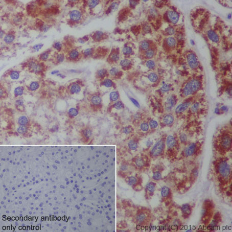 Immunohistochemistry (Formalin/PFA-fixed paraffin-embedded sections) - Anti-CPT2 antibody [EPR13626] - C-terminal (ab181114), expandable thumbnail