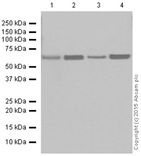 Western blot - Anti-CPT2 antibody [EPR13626] - C-terminal (AB181114), expandable thumbnail