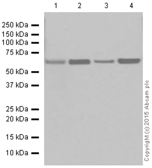 Western blot - Anti-CPT2 antibody [EPR13626] - C-terminal (AB181114)