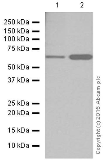 Western blot - Anti-CPT2 antibody [EPR13626] - C-terminal (AB181114), expandable thumbnail