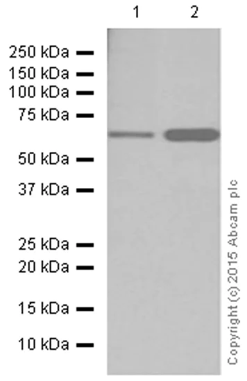 Western blot - Anti-CPT2 antibody [EPR13626] - C-terminal (AB181114)