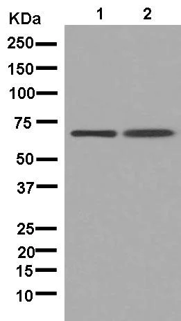 Western blot - Anti-CPT2 antibody [EPR13626] - C-terminal (AB181114)