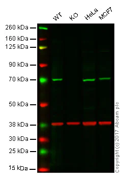 Western blot - Anti-CPT2 antibody [EPR13626] - C-terminal (AB181114)