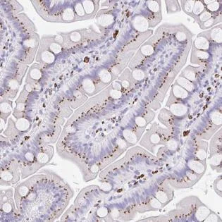Immunohistochemistry (Formalin/PFA-fixed paraffin-embedded sections) - Anti-CPTP antibody - N-terminal (AB185574)