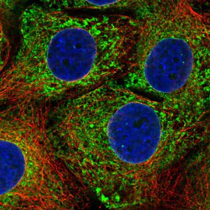 Immunocytochemistry/ Immunofluorescence - Anti-CPVL antibody (AB204553)